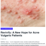 Press Release: Revivify: A New Hope for Acne Vulgaris Patients